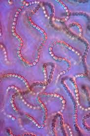 Attēlu rezultāti vaicājumam “Nostoc commune cells”