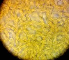 Attēlu rezultāti vaicājumam “Heterotrichia pomiformis (syn. Arcyria pomiformis)”