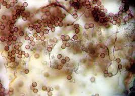 Attēlu rezultāti vaicājumam “Didymium proximum macro”