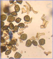 Attēlu rezultāti vaicājumam “Anthocerotopsida”
