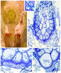 Attēlu rezultāti vaicājumam “Bryum pallens sporophyte”