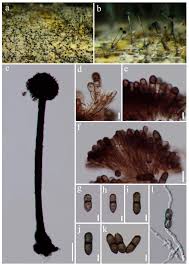 Attēlu rezultāti vaicājumam “Rosellinia desmazieri spores”