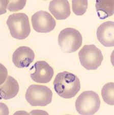 Attēlu rezultāti vaicājumam “Diderma umbilicatum plasmodium”