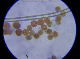 Attēlu rezultāti vaicājumam “Trachyspora intrusa”