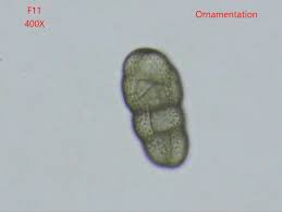 Attēlu rezultāti vaicājumam “Stemonitopsis aequalis var. microspora”