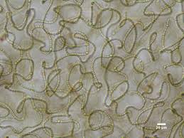 Attēlu rezultāti vaicājumam “Nostoc commune cells”