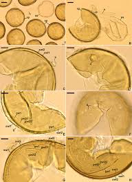 Attēlu rezultāti vaicājumam “Acaulon muticum sporophyte”