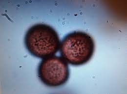 Attēlu rezultāti vaicājumam “Amaurochaete sp.”