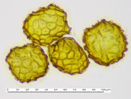 Attēlu rezultāti vaicājumam “Fossombronia foveolata sporophyte”