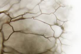 Attēlu rezultāti vaicājumam “Lamproderma pseudomaculatum”