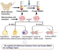 Image result for BMAC