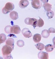 Attēlu rezultāti vaicājumam “Diderma umbilicatum plasmodium”