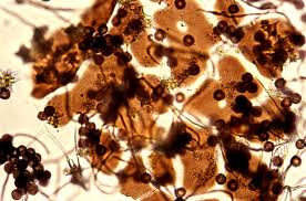 Attēlu rezultāti vaicājumam “Didymium melanospermum macro”