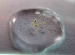 Attēlu rezultāti vaicājumam “Trichia alpina young”