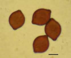 Attēlu rezultāti vaicājumam “Cribraria martinii spores”
