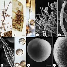 Attēlu rezultāti vaicājumam “Trichia crateriformis spores”
