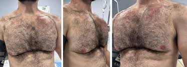 Image result for SYNTHOL