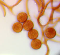 Attēlu rezultāti vaicājumam “Lycogala ustulatum macro”