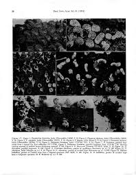 Attēlu rezultāti vaicājumam “Hemitrichia leiotricha spores”