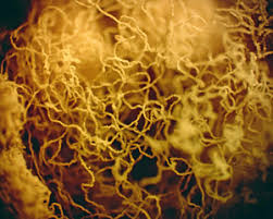 Attēlu rezultāti vaicājumam “Heterotrichia insignis (syn. Arcyria insignis) stalked”