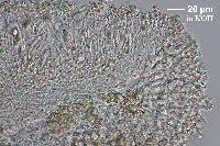 Attēlu rezultāti vaicājumam “Lecanora albella”