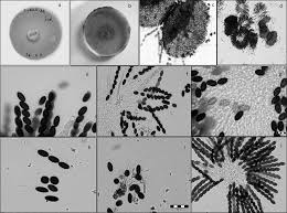Attēlu rezultāti vaicājumam “Sordaria fimicola”
