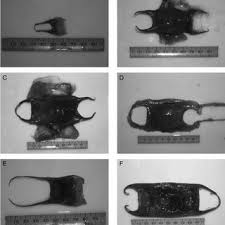 Image result for Raja straeleni