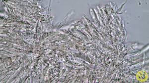 Attēlu rezultāti vaicājumam “Hyphodiscus hymeniophilus”