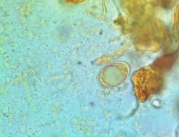 Attēlu rezultāti vaicājumam “Geopora arenicola”