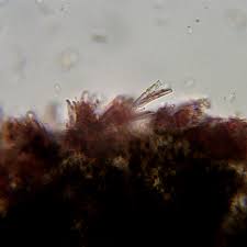 Attēlu rezultāti vaicājumam “Calicium salicinum”