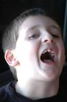 Ian's Teeth