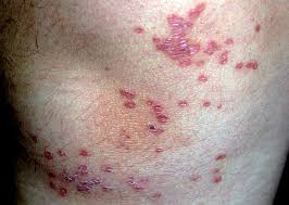 Image result for Lewandowsky-Lutz