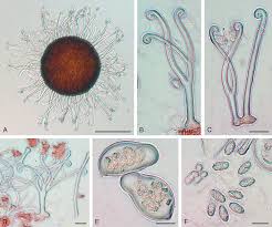 Attēlu rezultāti vaicājumam “Sawadaea tulasnei”