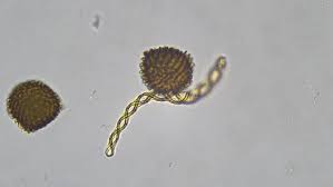 Attēlu rezultāti vaicājumam “Conocephalum salebrosum sporophyte”