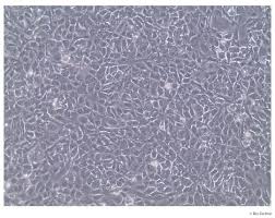 Attēlu rezultāti vaicājumam “Bryum funkii cells”