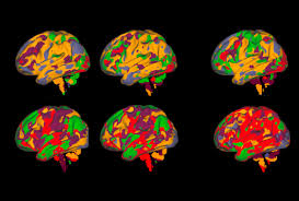 Image result for map of the brain