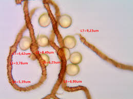Attēlu rezultāti vaicājumam “Trichia contorta sessile”