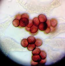 Attēlu rezultāti vaicājumam “Badhamia dubia spores”
