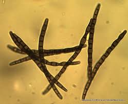 Attēlu rezultāti vaicājumam “Didymium difforme spores”