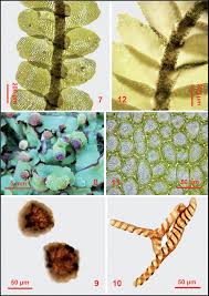 Attēlu rezultāti vaicājumam “Jungermannia hyalina cells”
