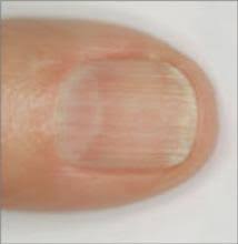 Image result for lunula nail