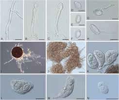 Attēlu rezultāti vaicājumam “Stemonitopsis aequalis var. microspora”