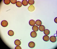 Attēlu rezultāti vaicājumam “Licea chelonoides spores”