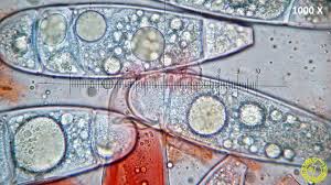 Attēlu rezultāti vaicājumam “Bactridium flavum”