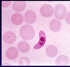 Attēlu rezultāti vaicājumam “Enteridium variabile plasmodium”