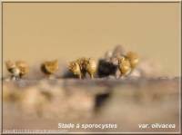 Attēlu rezultāti vaicājumam “Trichia crateriformis spores”