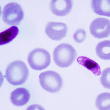 Attēlu rezultāti vaicājumam “Enteridium variabile plasmodium”