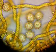 Attēlu rezultāti vaicājumam “Hemitrichia chrysospora”