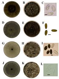 Attēlu rezultāti vaicājumam “Trichia longipalpis spores”