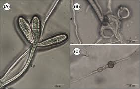 Attēlu rezultāti vaicājumam “Orbilia sp.”